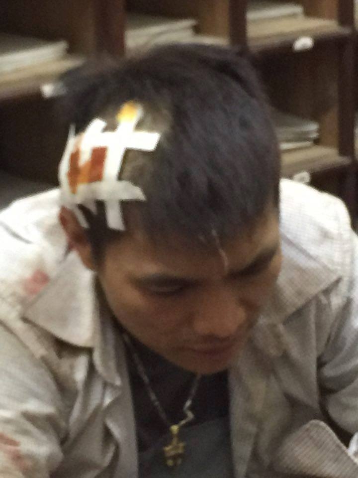 giam doc cong an lang son len tieng vu no sung bat toi pham ma tuy hinh anh 3