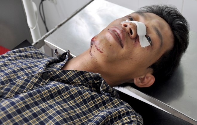 Vu xe khach va cham xe ben: Nhieu nan nhan nghi minh da chet hinh anh 1