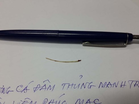 Cứu sống bệnh nhân bị xương cá đâm thủng ruột - ảnh 1