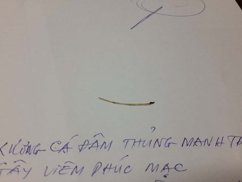 Cứu sống bệnh nhân bị xương cá đâm thủng ruột - ảnh 2