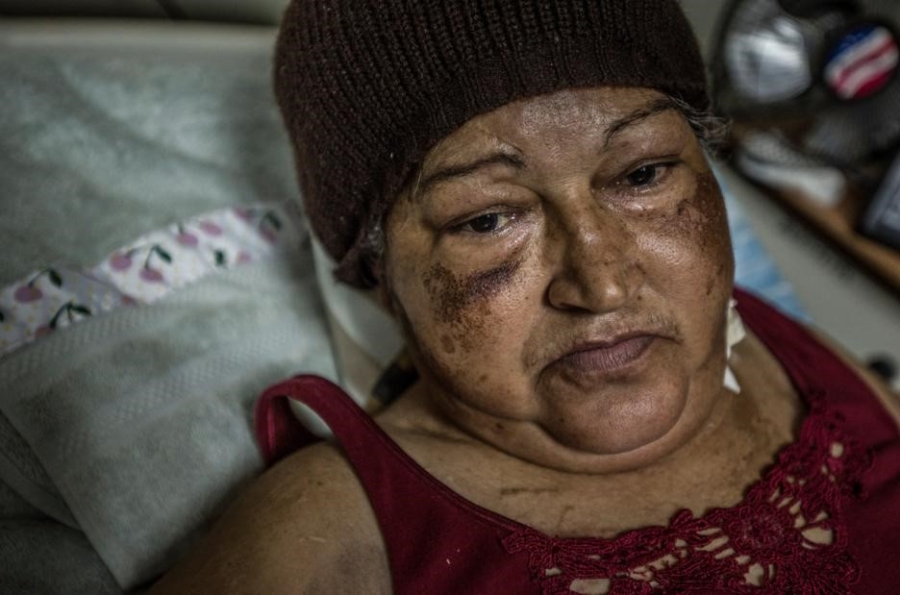 Benh vien Venezuela nhu o the ky 19 vi khung hoang kinh te hinh anh 9