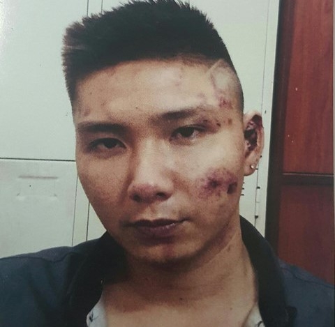 Mau thuan loi khai chem khach trong quan bar o Sai Gon hinh anh 1