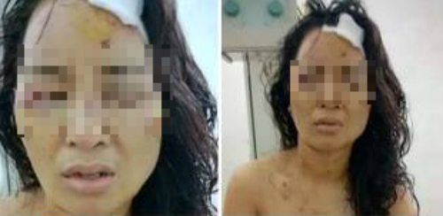 Lộ tin nhắn khiến cô giáo bị chồng cũ đánh bầm tím khắp cơ thể - Ảnh 2