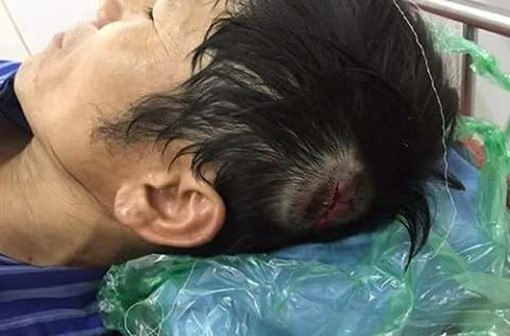 Nhom con do di oto truy sat 11 cong nhan boc xep hinh anh 1