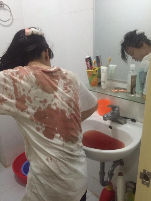 Gái trẻ bị giật túi xách ngã bất tỉnh 'suýt chết' trên phố Hà Nội - Ảnh 3