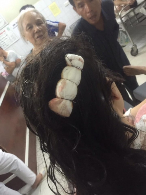 Gái trẻ bị giật túi xách ngã bất tỉnh 'suýt chết' trên phố Hà Nội - Ảnh 4