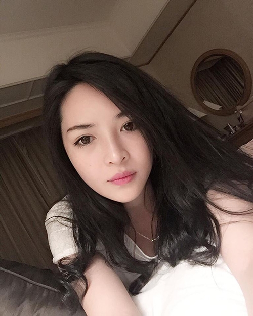 cuoc doi sang trang cua co gai lot xac nho phau thuat tham my - 8