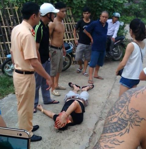  Nam thanh niên được cho là bị CSGT bắn súng vào đầu. Ảnh người dân cung cấp 