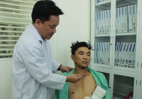 Bi ban 3 phat sung vi can con do danh anh trai hinh anh 1