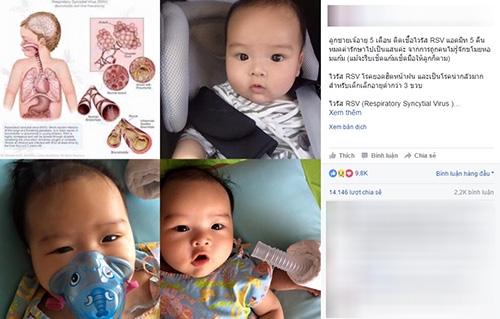 be 5 thang suyt chet vi bi nguoi la hon, me buc boi len facebook canh bao - 1