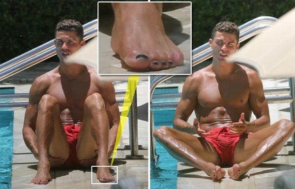 Cristiano Ronaldo, chấn thương, Real Madrid, La Liga