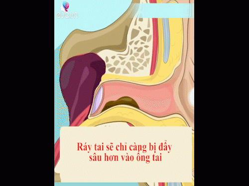 rat nhieu ba me se khong con dung bong ngoay tai tre khi biet su that nay! - 1