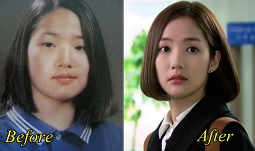 Park Min Young bi nghi tiep tuc dao keo hinh anh 3