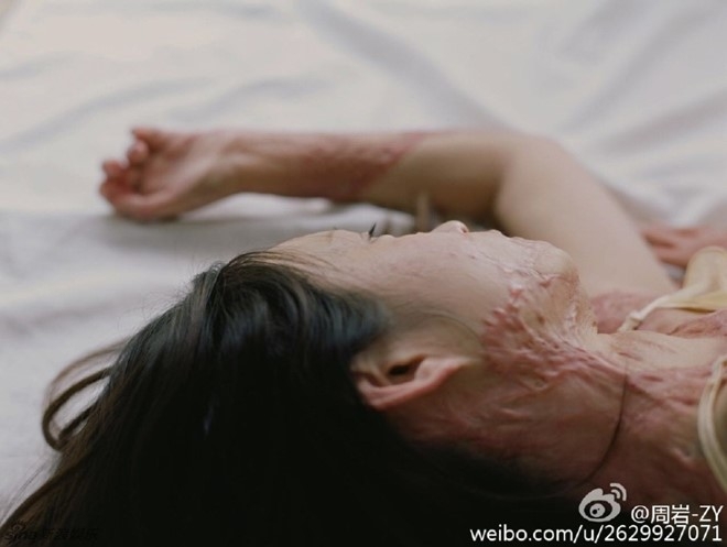 Nguoi mau teen tung bi thieu song vi tinh lo dien sau 5 nam hinh anh 5