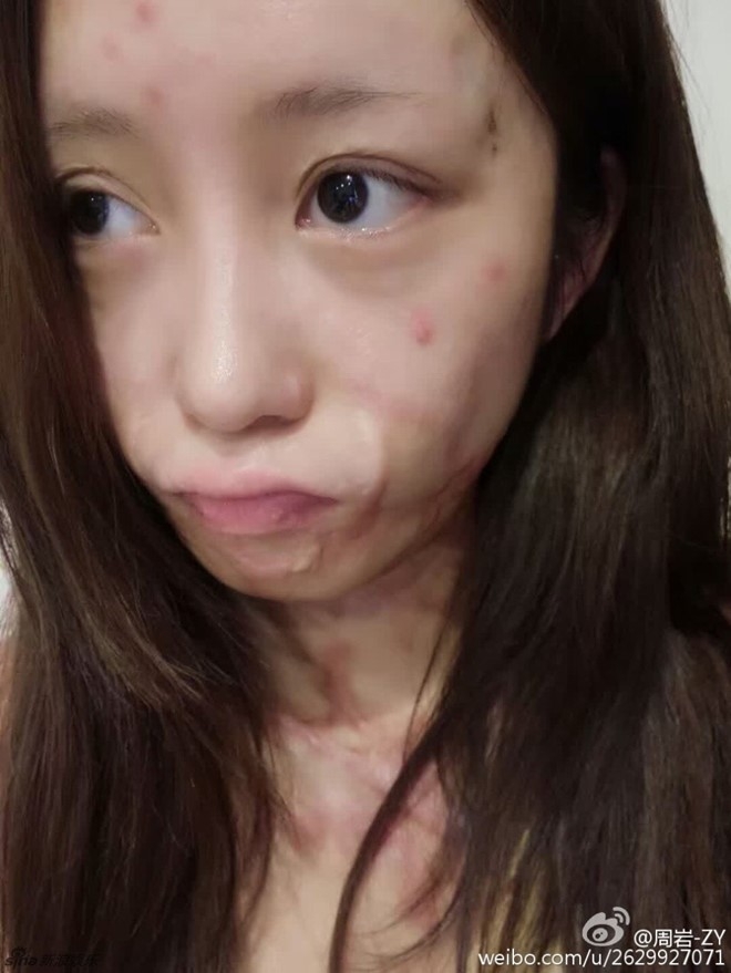 Nguoi mau teen tung bi thieu song vi tinh lo dien sau 5 nam hinh anh 6