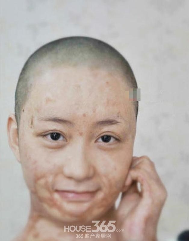 Nguoi mau teen tung bi thieu song vi tinh lo dien sau 5 nam hinh anh 10