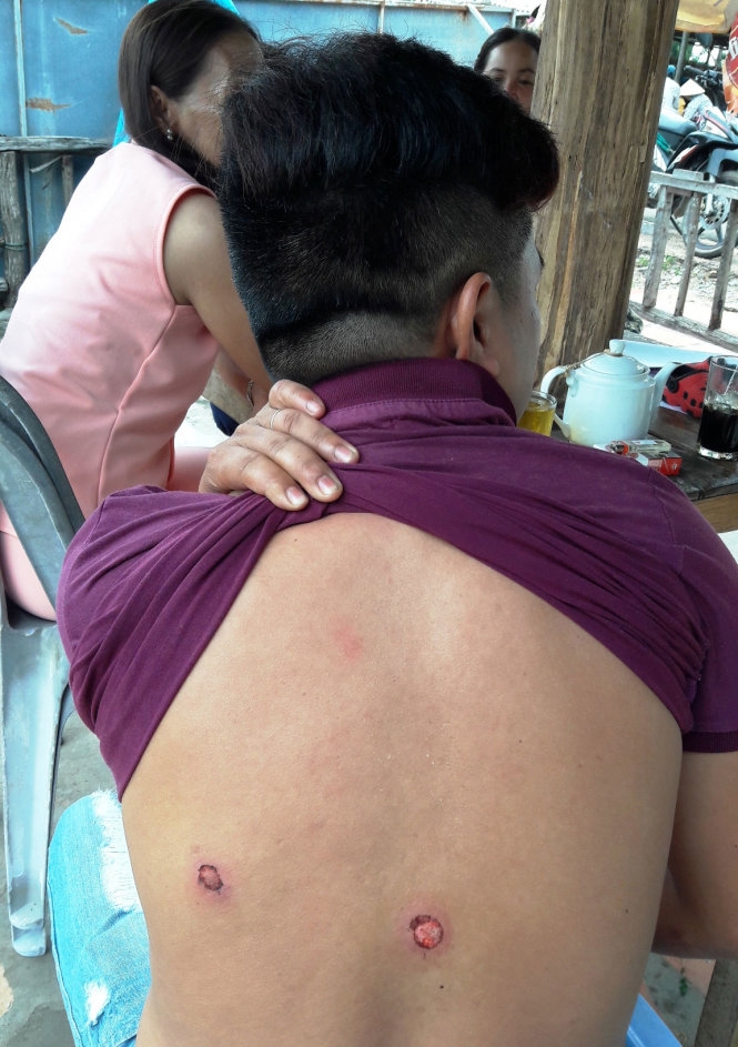 Trưởng công an xã tới nhà bắn dân 