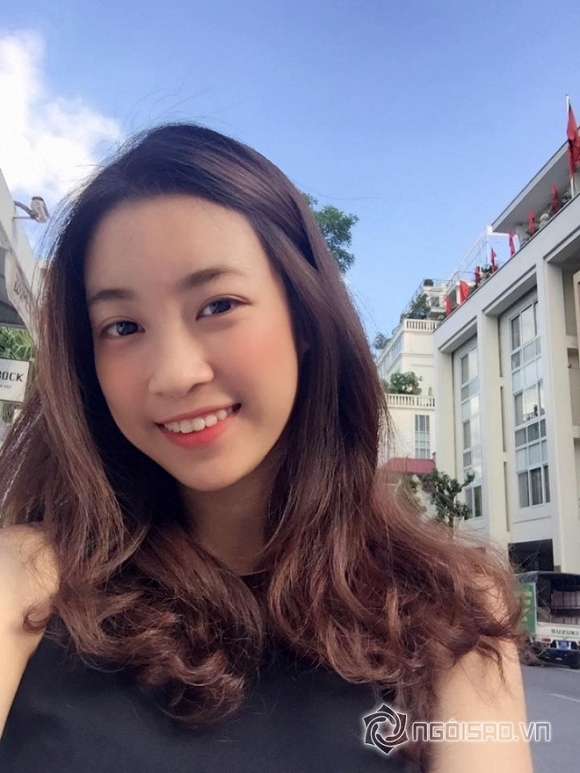 Hoa hậu Việt Nam dính nghi án phẫu thuật răng 3