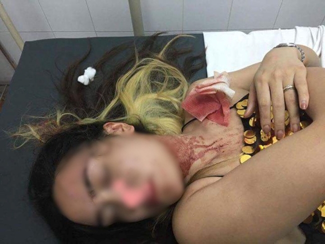 Hà Nội: Cô gái mang bầu 2 tháng tố bị nhân viên quán Bar đánh nhập viện - Ảnh 1.
