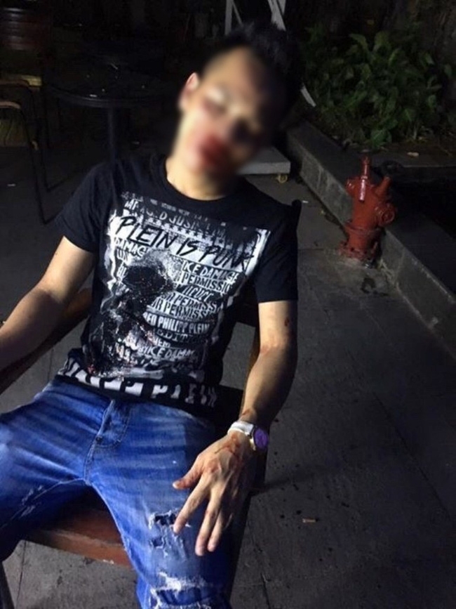 Hà Nội: Cô gái mang bầu 2 tháng tố bị nhân viên quán Bar đánh nhập viện - Ảnh 2.