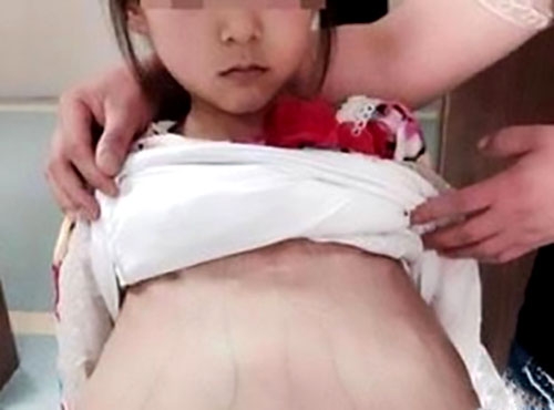 mang-thai-o-tuoi-12-ton-hai-den-suc-khoe-nhu-the-nao