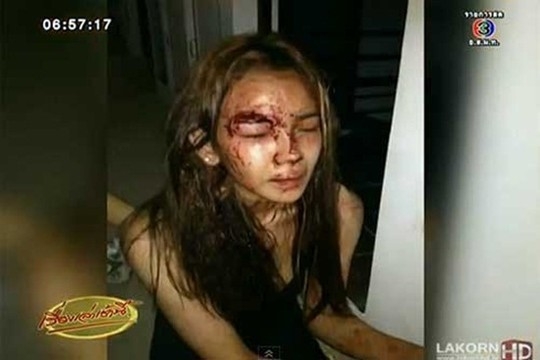 Sao nu Thai Lan tram cam sau khi suyt bi tho xay cuong buc hinh anh 2