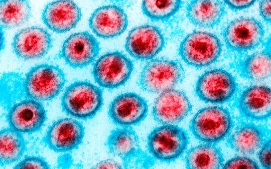  Virus HIV. Ảnh: Alamy 