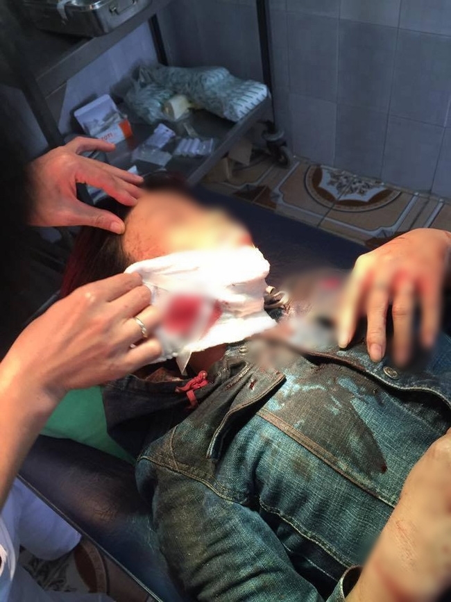 Nghi vấn người phụ nữ bị tên cướp giật túi xách, dùng dao cứa rách cổ - Ảnh 2.