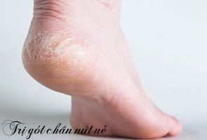 dung-an-duong-hay-dung-duong-de-lam-dep-tu-dau-den-chan-2