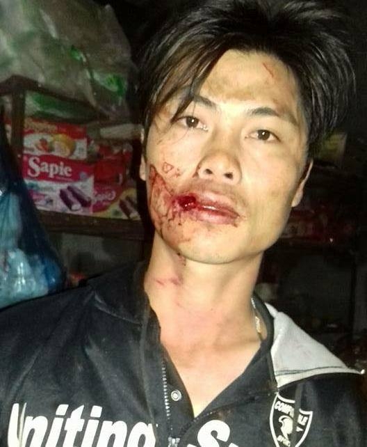  Ông Sang cho rằng bị đánh bầm dập sau khi quay cảnh công an xã chặm xe. Ảnh người dân cung cấp 