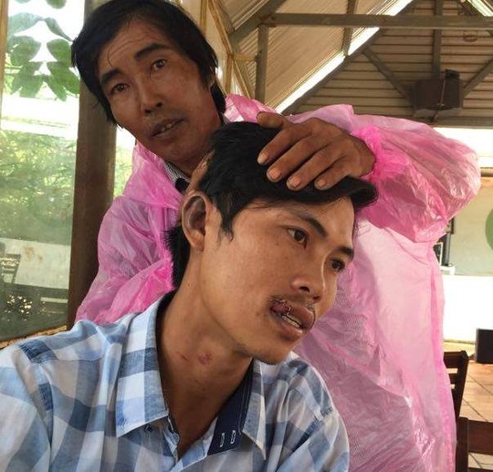  Nhiều vết thương ở miệng, tai, cổ của ông Sang 
