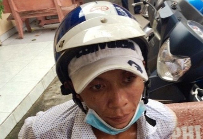 Di chau di chua benh bi ten cuop dap nga o Sai Gon hinh anh 1