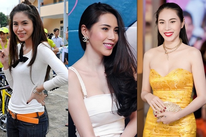 Sao Việt biến đổi gương mặt khi dùng các biện pháp làm đẹp