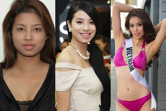Sao Việt biến đổi gương mặt khi dùng các biện pháp làm đẹp