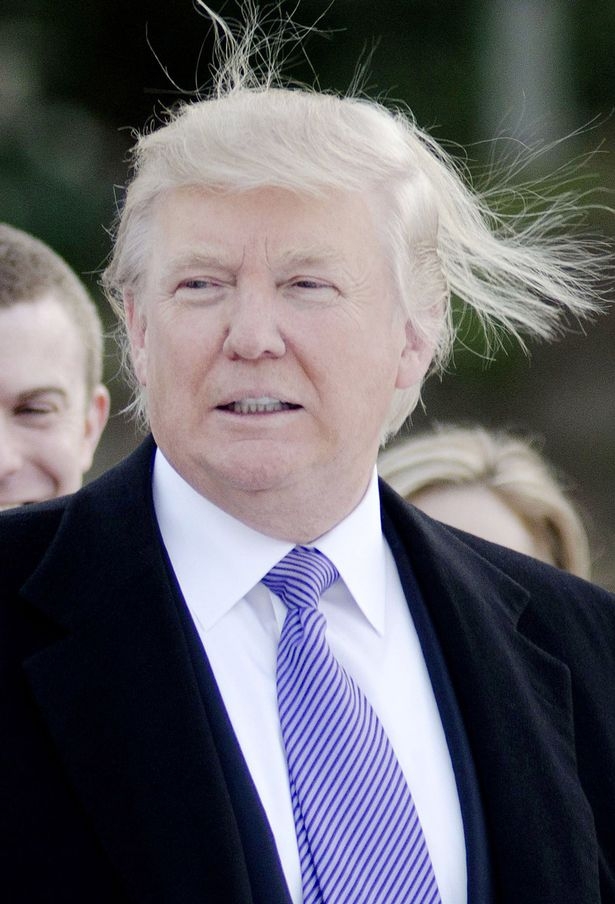 Sự thật về mái tóc kì lạ của Donald Trump - 3