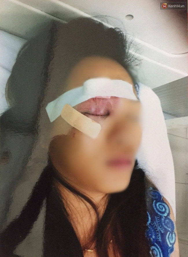 Người bán hàng rong hoảng sợ nhớ lại giây phút bị 20 thanh niên truy sát ở Sài Gòn - Ảnh 1.