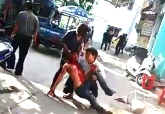 Danh chem o bua tiec, nhieu nguoi bi thuong hinh anh 1
