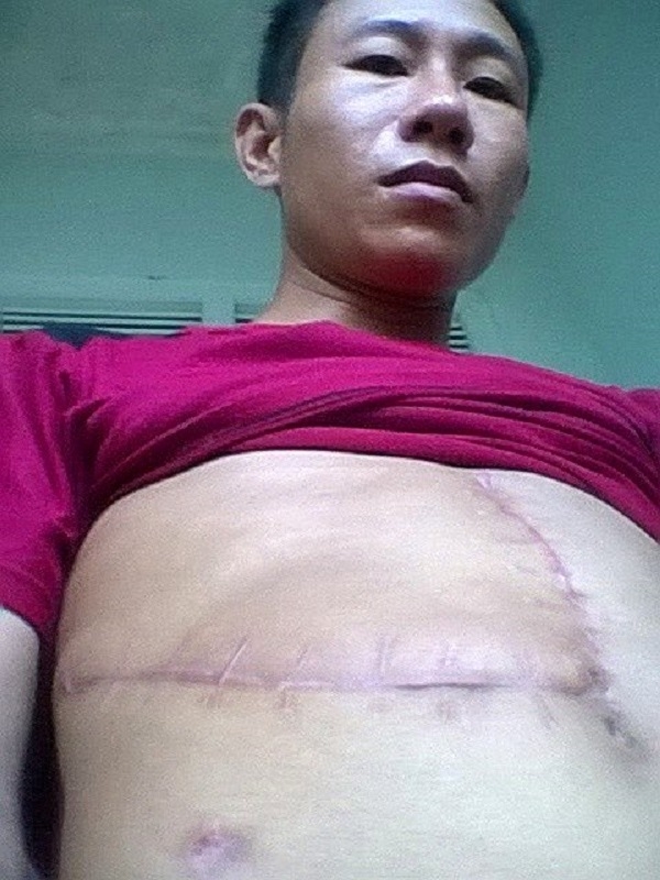 nan nhan bi bay trau dien tan cong o quang tri bi lam kho? hinh anh 1