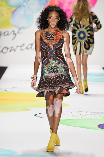  Winnie Harlow hiện tại rất đắt show quảng cáo và trình diễn thời trang. Winnie tiết lộ khi còn đi học, cô khổ sở vì làn da bò sữa và luôn bị bạn bè chọc ghẹo tới mức khi học cấp 3, cô phải bỏ học ngang chừng. Giờ đây khi đã thành người mẫu nổi tiếng, Winnie Harlow kêu gọi bình đẳng cho phụ nữ mọi màu da, mọi lứa tuổi. Bản thân cô cũng là 1 nhà hoạt động xã hội tích cực. 