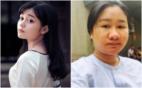 Tâm sự buồn của cô gái từng xinh như hot girl trở nên xấu tột độ vì mang bầu - Ảnh 5.
