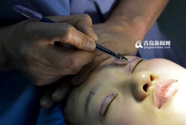 Cô gái 19 tuổi bất chấp tất cả phẫu thuật để trở thành Lưu Diệc Phi thứ hai - Ảnh 6.