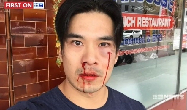 Dien vien goc Viet bi danh me rang, chay mau mui o Australia hinh anh 1
