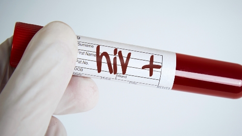 sap-co-vacxin-tri-hiv