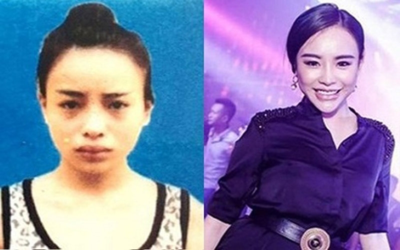 co gai phau thuat thanh hotgirl de tron na co bi tang hinh phat? hinh anh 1