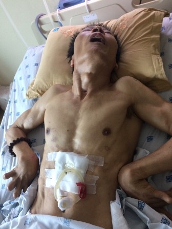 Sau thủ thuật, ông Trịnh Quang Sơn bị tai biến sống thực vật hơn 1 năm qua
