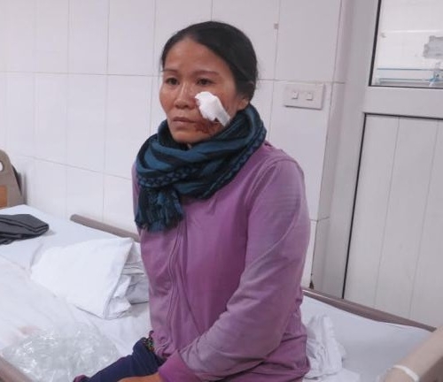 lat xe o nghe an 14 nguoi nhap vien: hanh khach ke lai giay phut sinh tu - 2