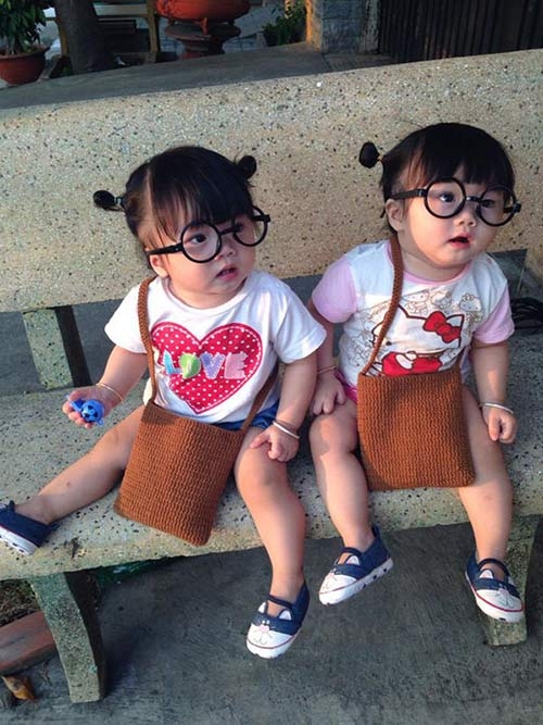 hai co nhoc song sinh dang yeu tua bup be dang khien dan tinh