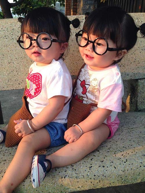 hai co nhoc song sinh dang yeu tua bup be dang khien dan tinh