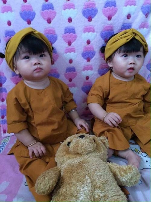 hai co nhoc song sinh dang yeu tua bup be dang khien dan tinh