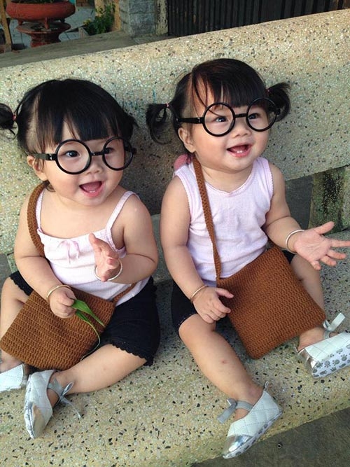 hai co nhoc song sinh dang yeu tua bup be dang khien dan tinh